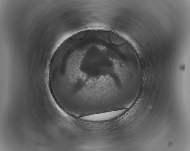 X0000100361383200806131005