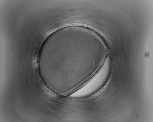 X0000100361497200806131003