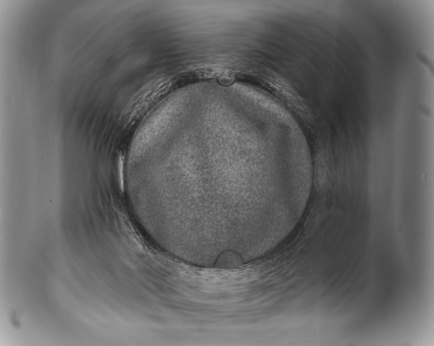 X0000100360022200806201615