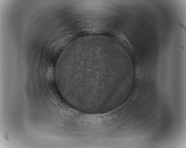 X0000100360029200806201615