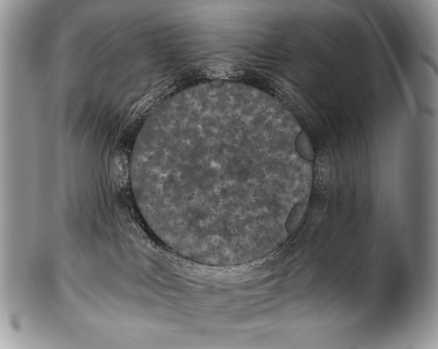 X0000100360043200806201614