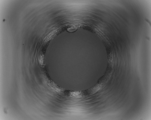 X0000100360139200806201613