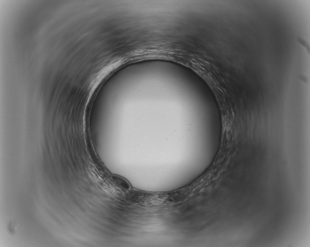 X0000100360148200806201612