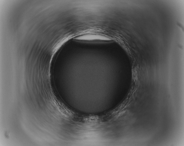 X0000100360196200806201612