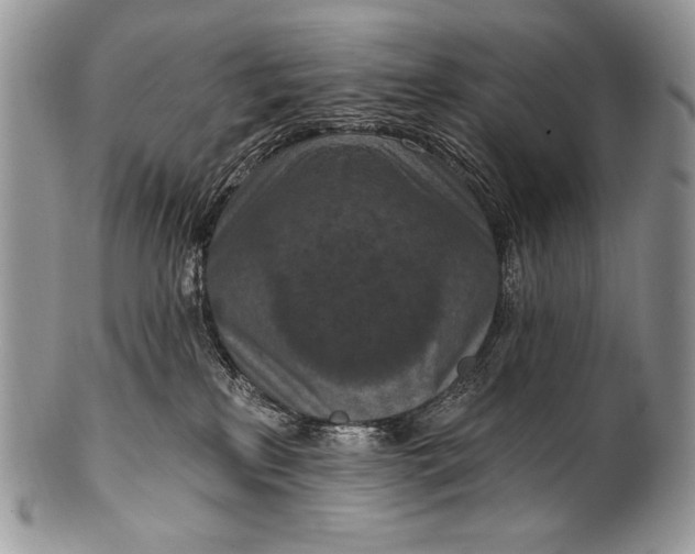 X0000100360233200806201612