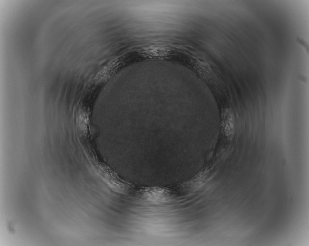 X0000100360235200806201611