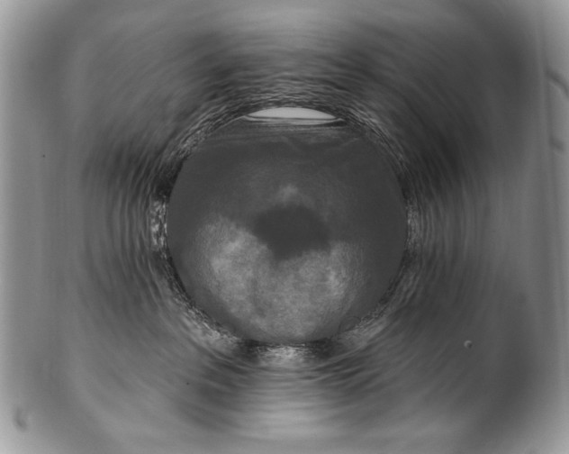 X0000100360237200806201611