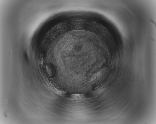 X0000100360239200806201611