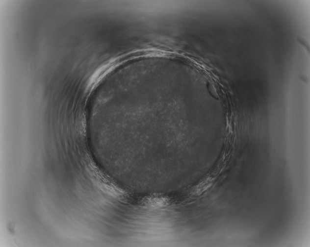 X0000100360247200806201611