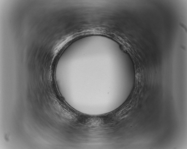 X0000100360248200806201611