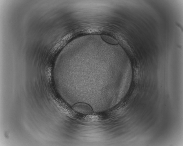 X0000100360260200806201611