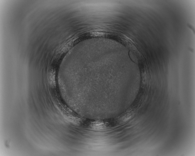 X0000100360267200806201611