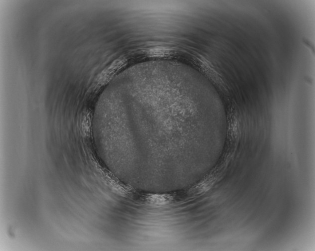 X0000100360277200806201611