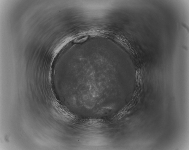 X0000100360292200806201611