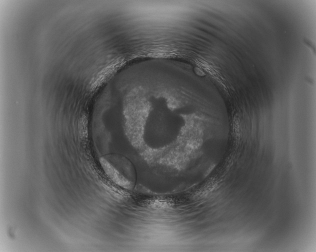 X0000100360303200806201611