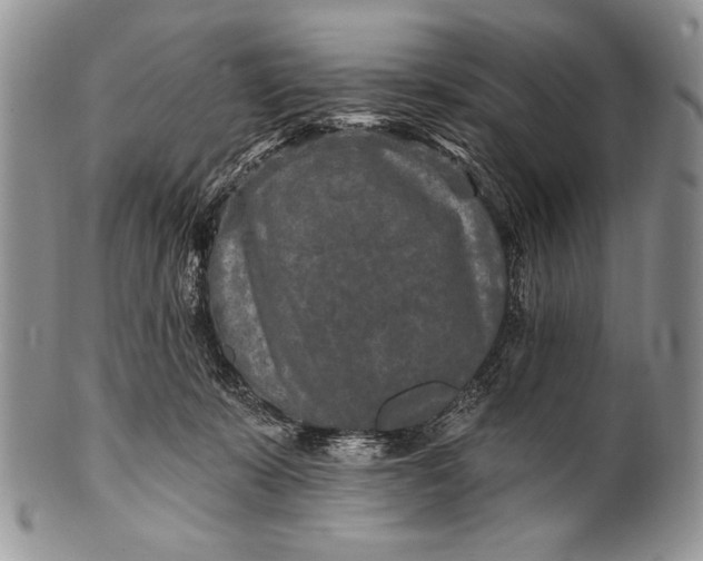 X0000100360319200806201610