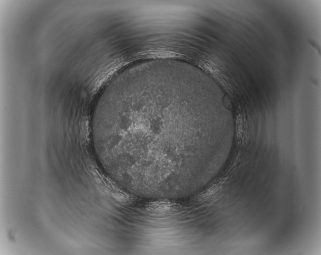 X0000100360351200806201610