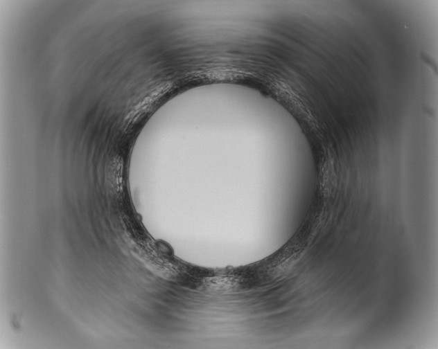 X0000100360356200806201610