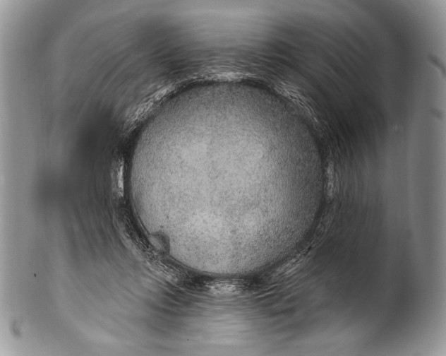 X0000100360358200806201610