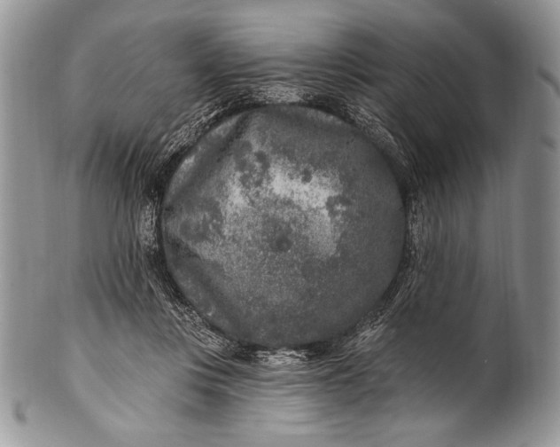 X0000100360359200806201610