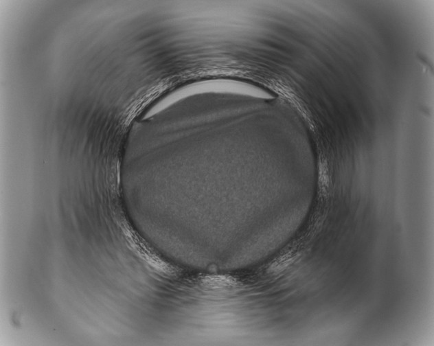 X0000100360397200806201609