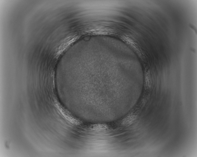 X0000100360398200806201609