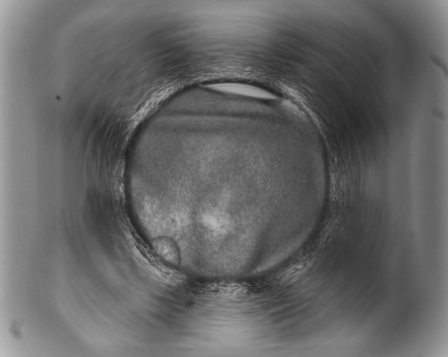 X0000100360443200806201608