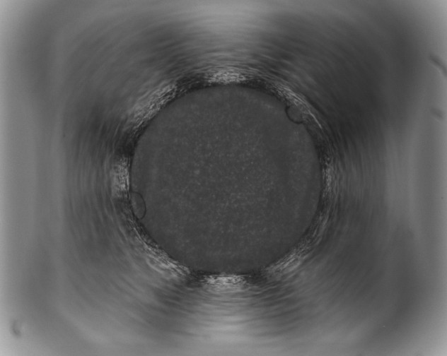 X0000100360517200806201607