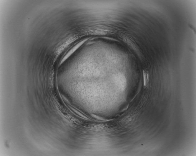 X0000100360675200806201605