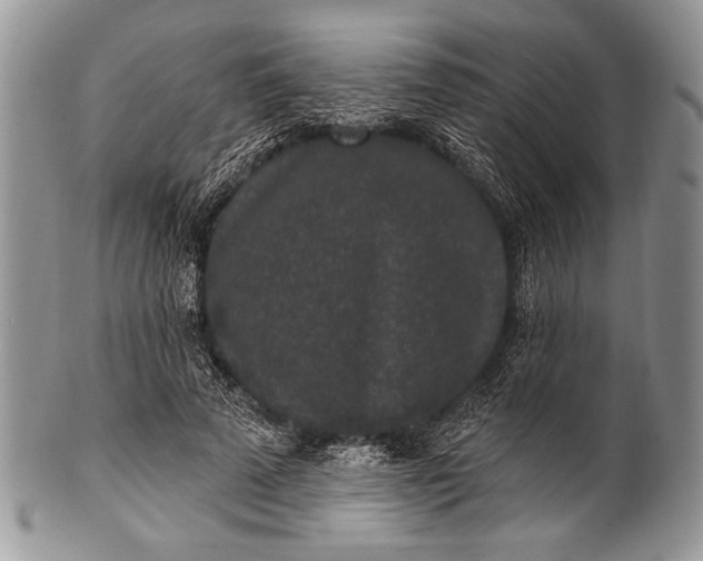 X0000100360689200806201605