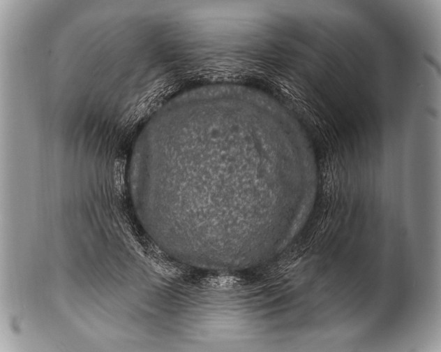 X0000100360695200806201605