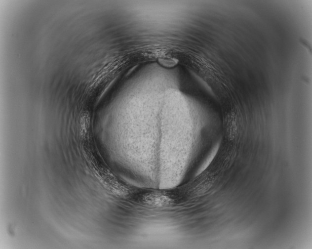 X0000100360747200806201604