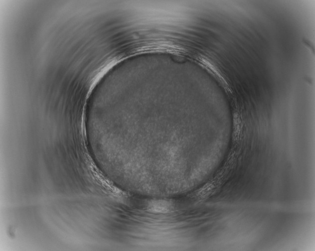 X0000100360788200806201603