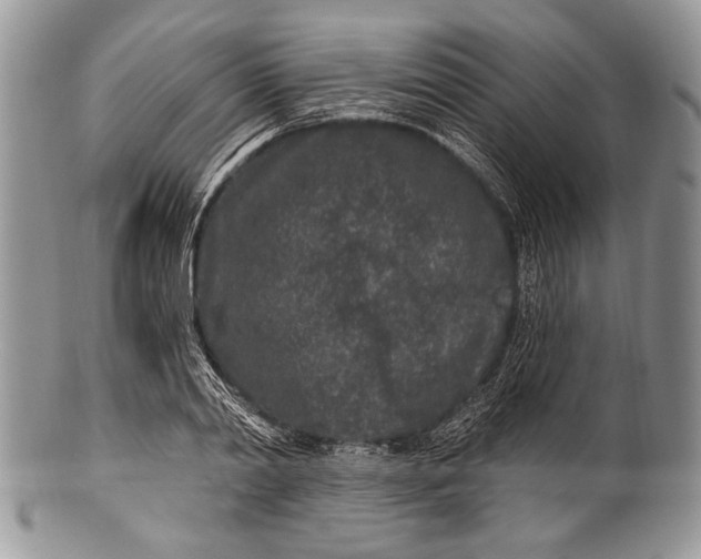 X0000100360790200806201603