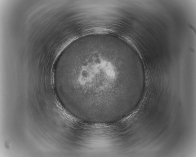 X0000100360835200806201602