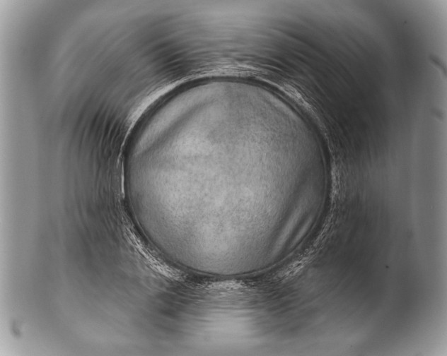 X0000100360838200806201602