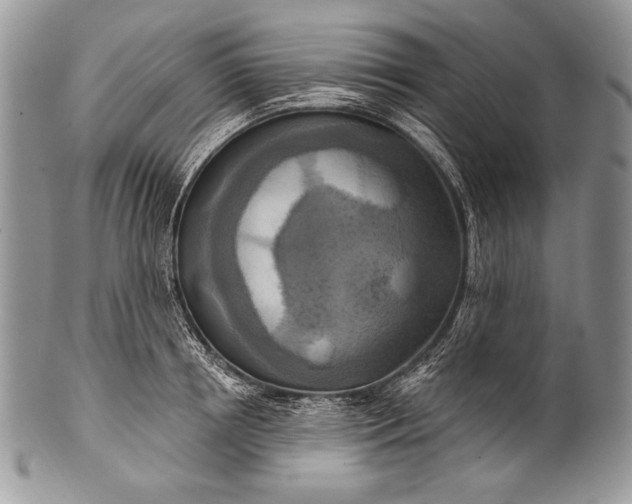 X0000100360850200806201603