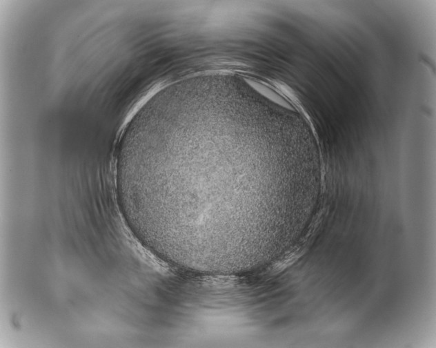 X0000100360859200806201603