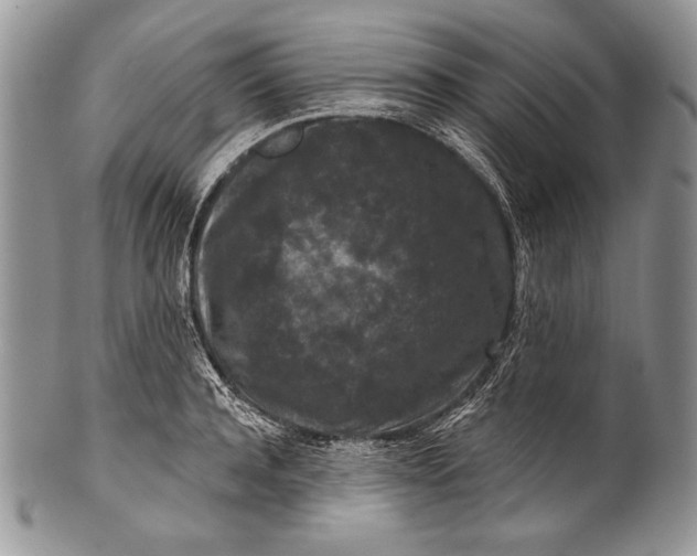 X0000100360944200806201601