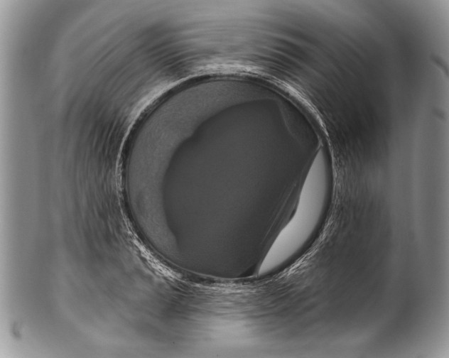 X0000100361037200806201600