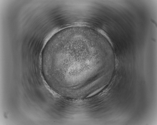 X0000100361099200806201559