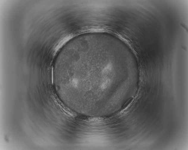 X0000100361171200806201558