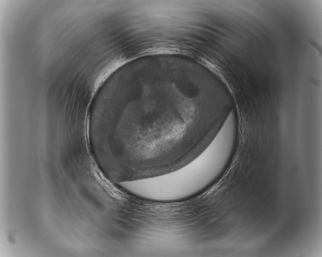 X0000100361179200806201557