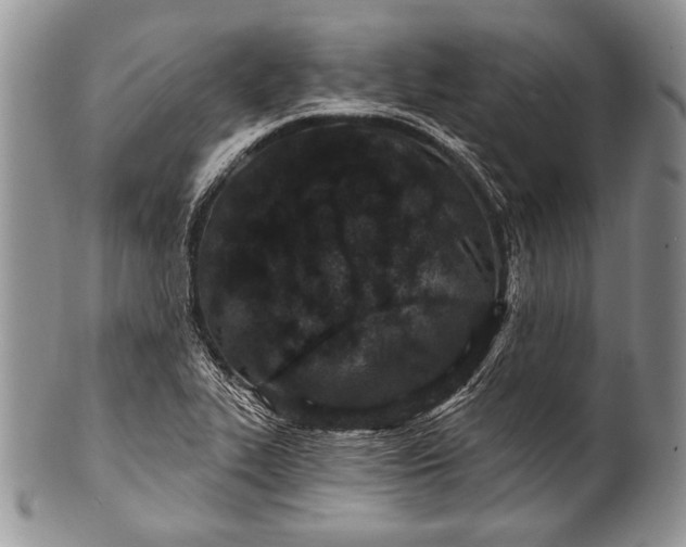 X0000100361319200806201555