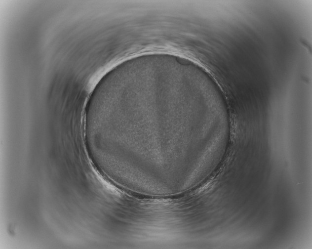 X0000100361519200806201552