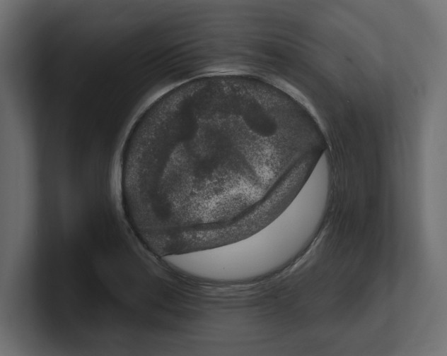 X0000100361179200806271417