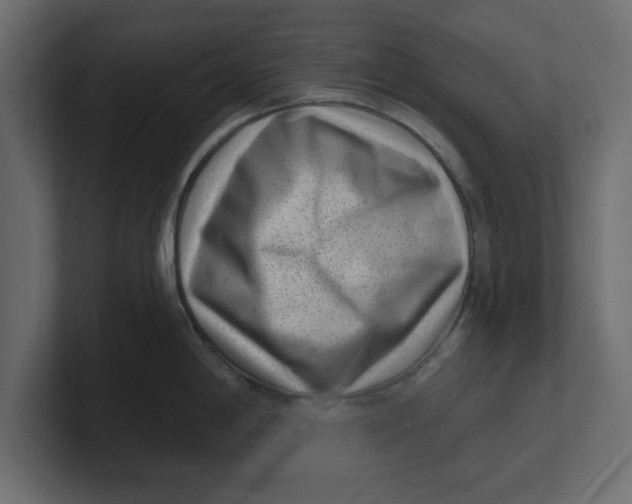 X0000100361198200806271417