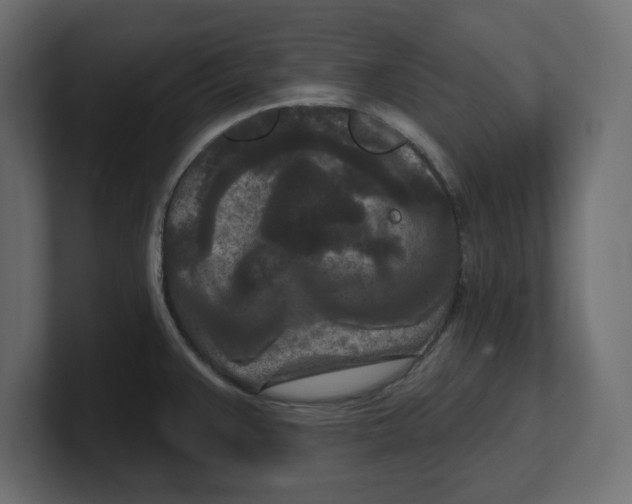 X0000100361383200806271414