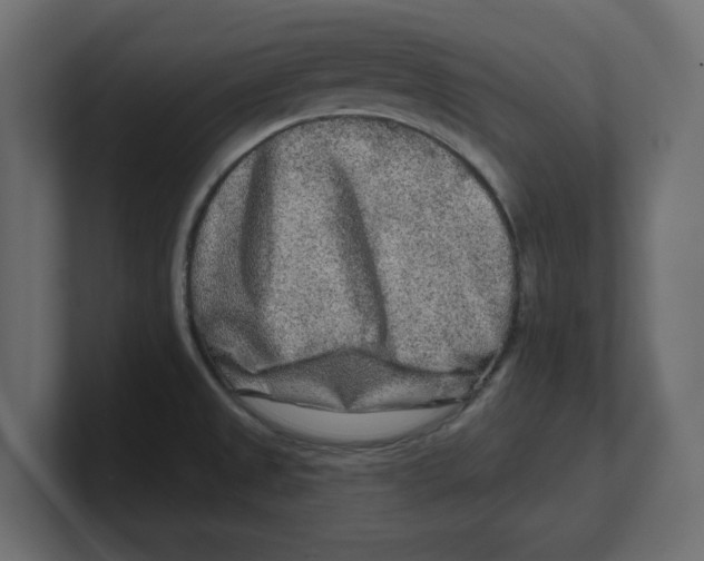 X0000100361525200806271413