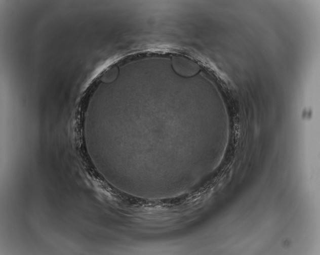 X0000100371256200806061147